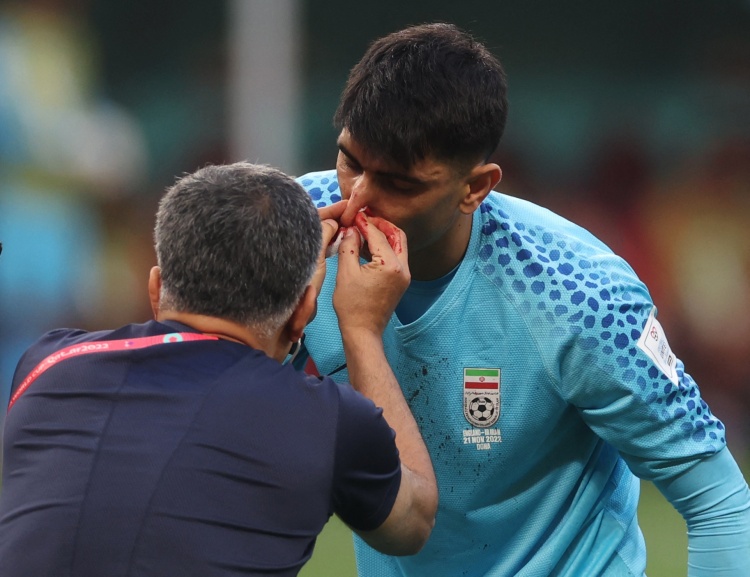 记者：FIFA告知伊朗应遵守脑震荡协议，不允许贝兰万德在下轮出场