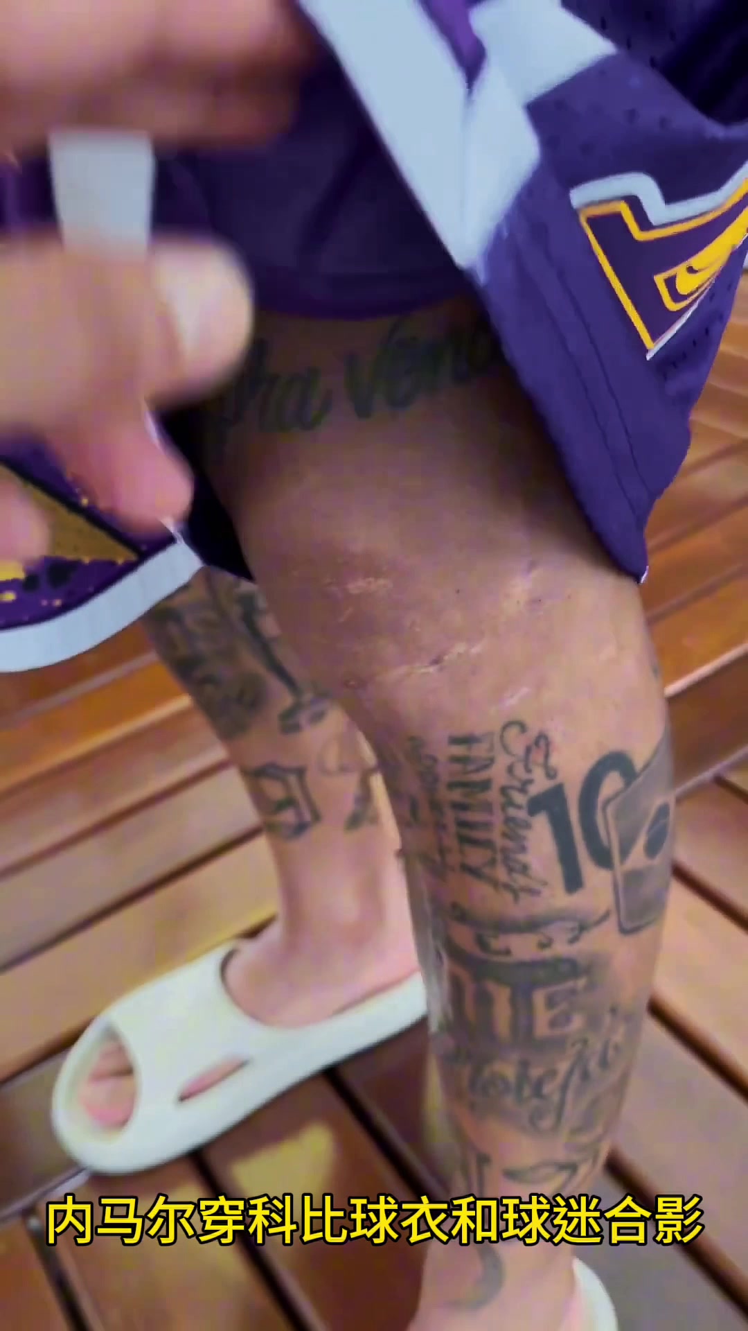 内马尔穿科比球衣和球迷合影，腿上伤疤清晰可见